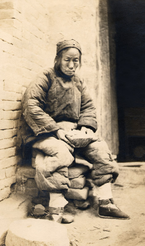 Suffering famine. Photographer unknown, Silver Print 1920-1921 - © Carlo Sacco