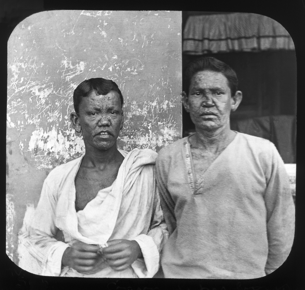 Two lepers. India 1900