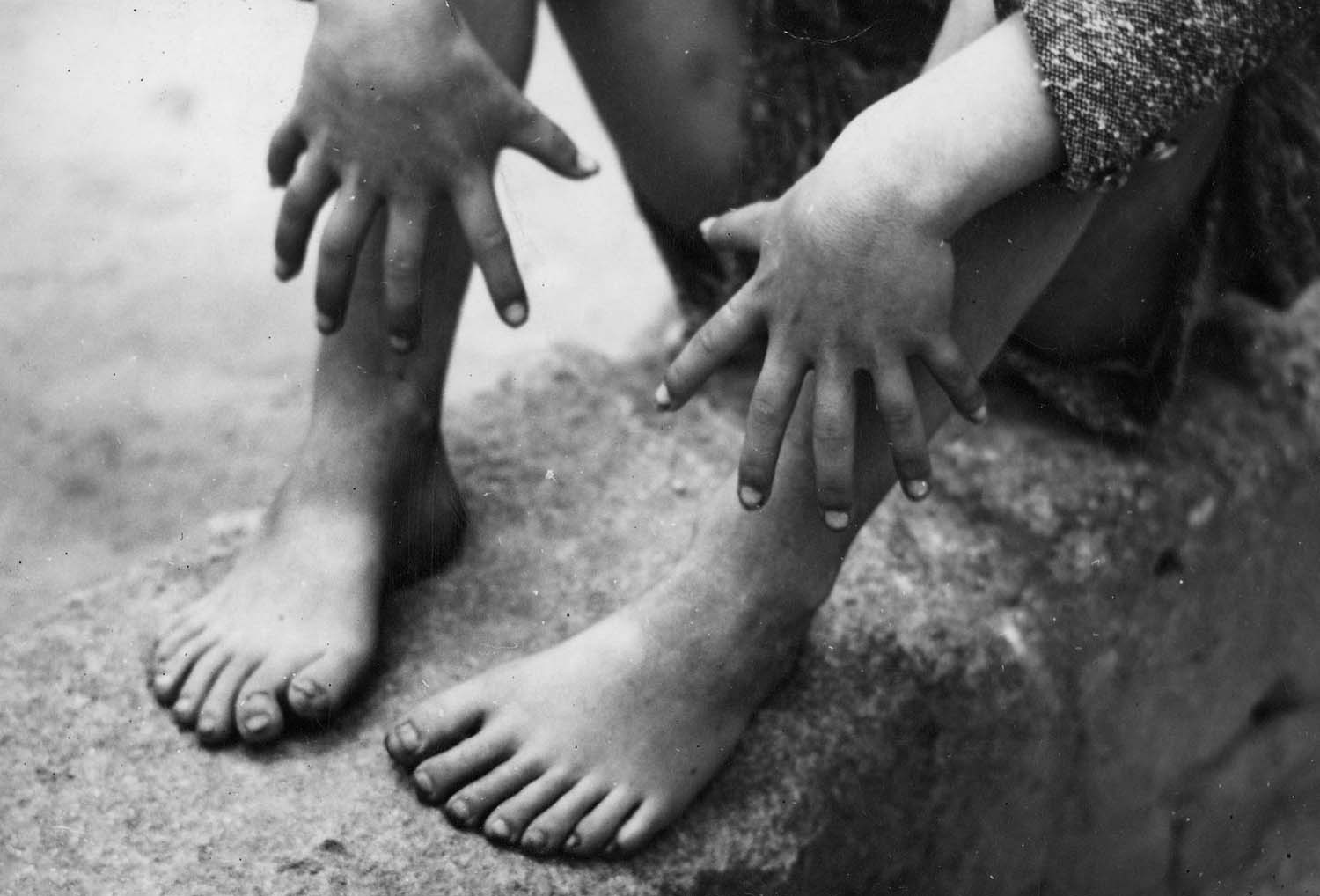 Photograph of a fisherman made by Benito Sacco in Stromboli during '60 showing this man having 6 fingers on hands and 7 on feets. Carlo Sacco Collection.
